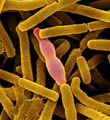 Bacillus anthracis.jpg